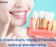 chto-nuzhno-znat-pered-ustanovkoy-zubnykh-implantatov