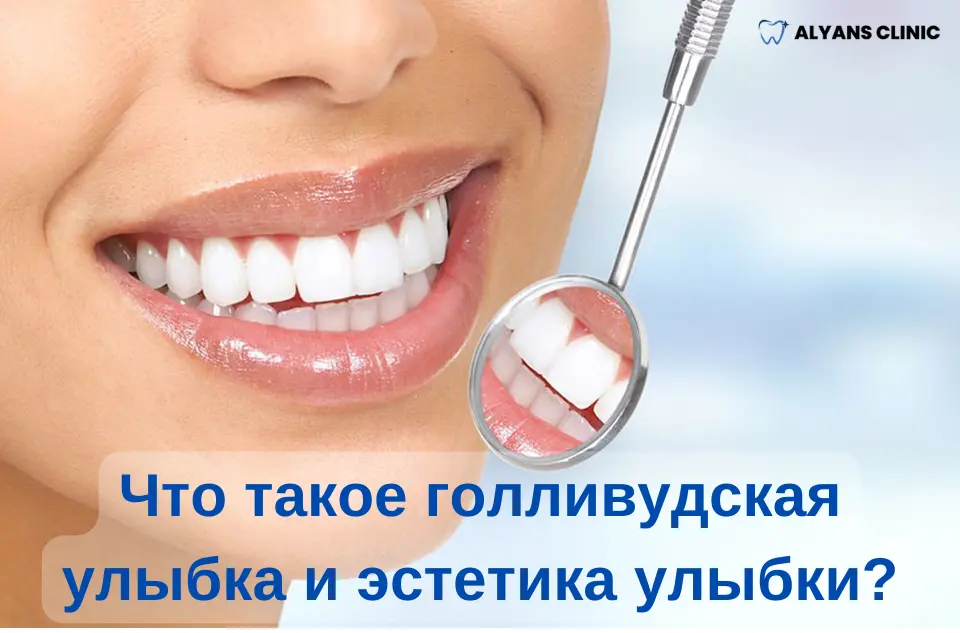 chto-takoe-gollivudskaya-ulybka-i-estetika-ulybki