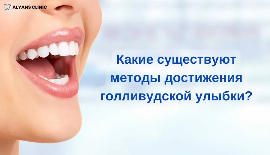 kakie-sushchestvuyut-metody-dostizheniya-gollivudskoy-ulybki