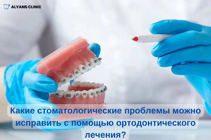 problemy-ispravimye-ortodontiey