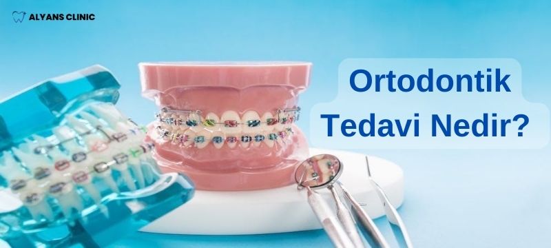 ortodontik tedavi nedir ne demektir