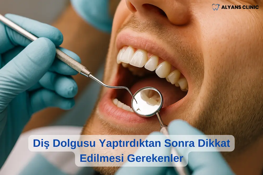 Diş Dolgusu Yaptırdıktan Sonra Dikkat Edilmesi Gerekenler