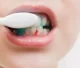 gum-bleeding-causes-treatments