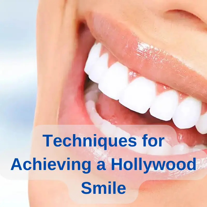 hollywood smile techniques