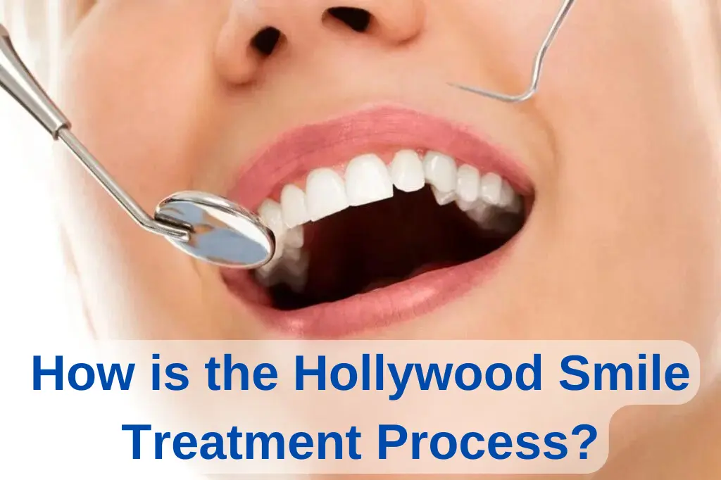 hollywood smile treatment process