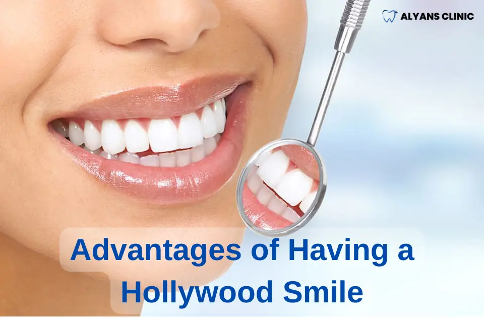 Advantages of Having a Hollywood Smile