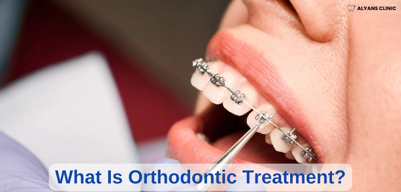 What Is Orthodontic Treatment